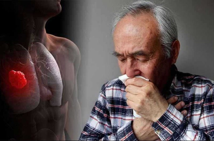 Napok óta köhögsz és semmi sem hat? Ez okozza valójában a betegséged!