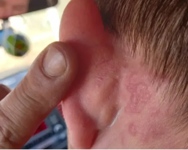 Bőrgyógyász: ha ezt a testrészedet nem mosod meg mindennap, durva betegségeket kockáztatsz