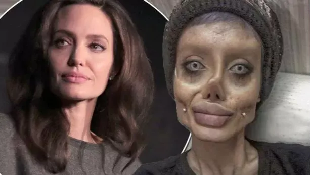 Mi történt Angelina Jolie-val? Te felismered?