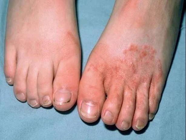 Rejtett betegség tizedeli a magyarokat! Azonnal hívd az orvost, ha ezt tapasztalod!