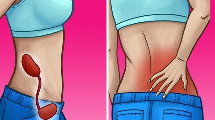 A petefészekrák 6 tünete, amit nem ismernek a nők