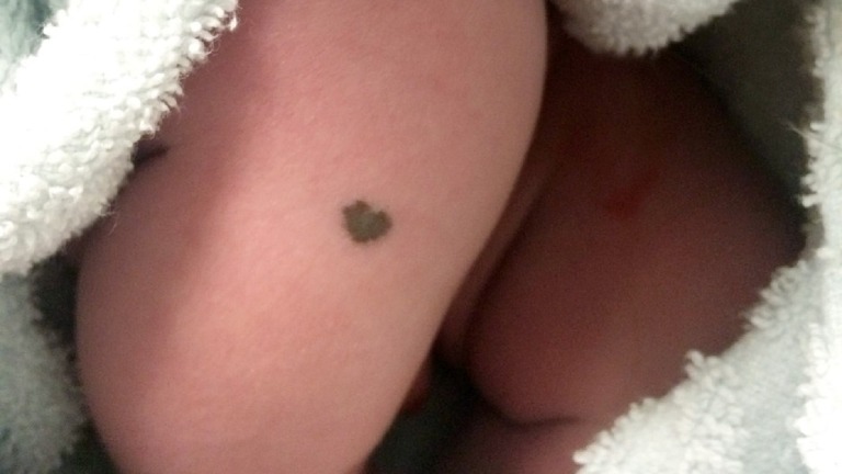 Egy 53 éves nő ikreket szül, de a veje ismerős anyajegyeket vesz észre a piciken