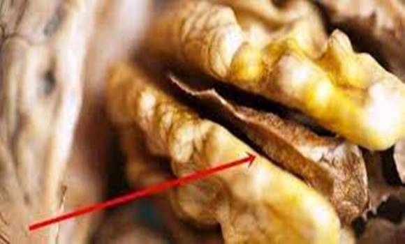 Ha megtörsz egy diót ne dobd el ezt a részét, mert aranyat ér!