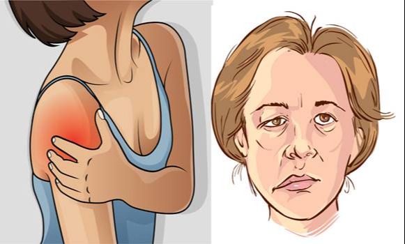 10 riasztó tünet, ami a közeledő stroke jele