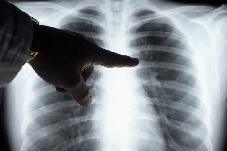 2050-re ezek a betegségek pusztítóbbak lesznek a ráknál