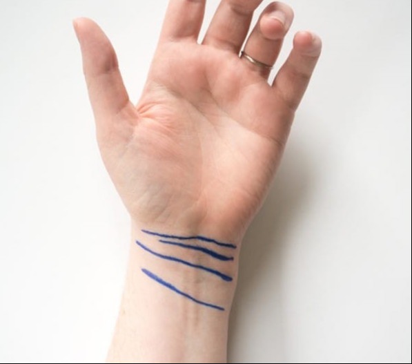 Feltárul a jövőd titka: nézd meg a csuklódat, ezt jelenti rajta a "karkötő vonal"