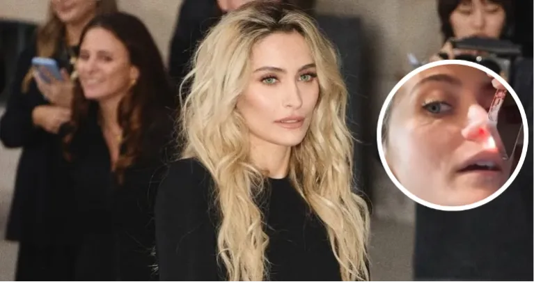 Michael Jackson lánya megmutatta, mit tett a testével a drog