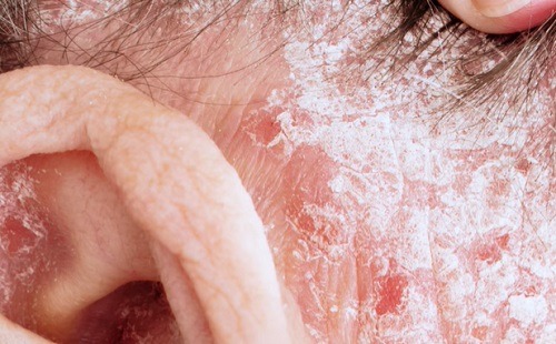 Ha nem szedsz elég D-vitamint, ez a 7 betegség téged is fenyeget