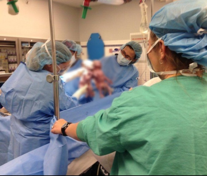 Az orvosok megbénultak a félelemtől: mit szült ez a nő?